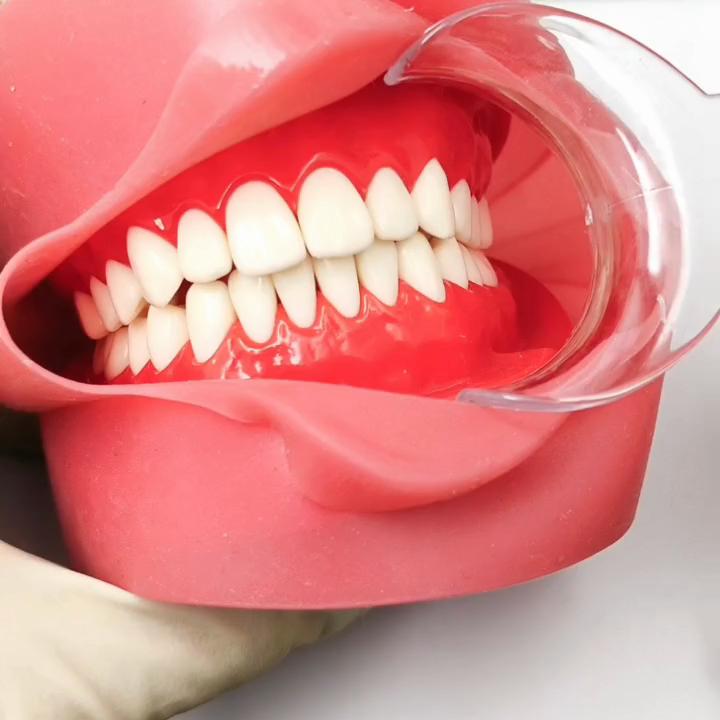 Двойные концы стоматологический ортодонтический втягиватель для губ и щек Двойные концы открывалка для рта фотосерый инструмент для отбеливания зубов инструменты дантиста