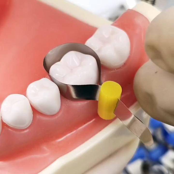 Стоматологическая матрица Tofflemire для глубокого подъема края Матрицы большой кривизны Стоматологический материал Секционная контурная матрица