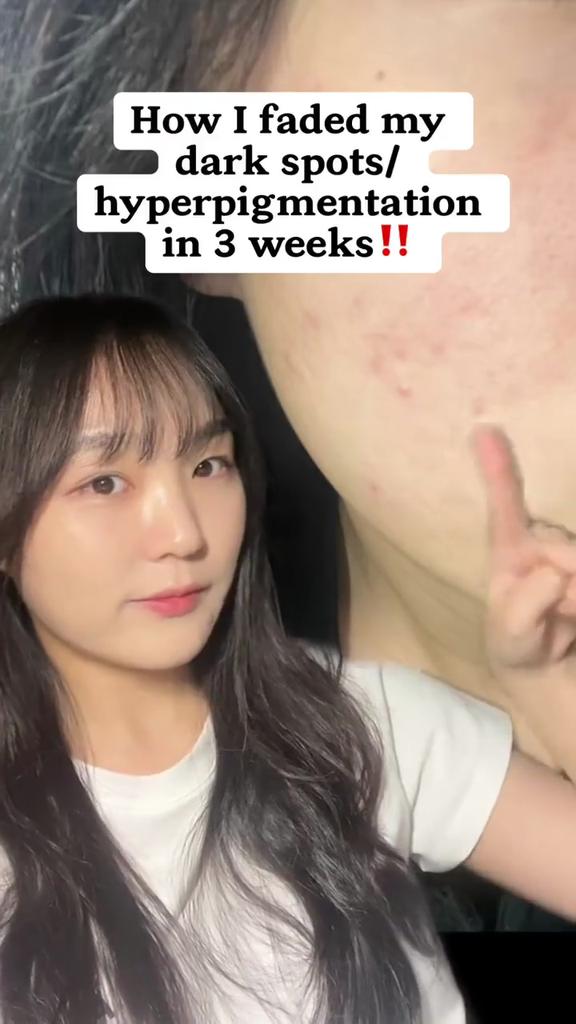 NUMBUZIN №5 Концентрированные подушечки с витаминами и ниацинамидом, 180 мл/70 подушечек