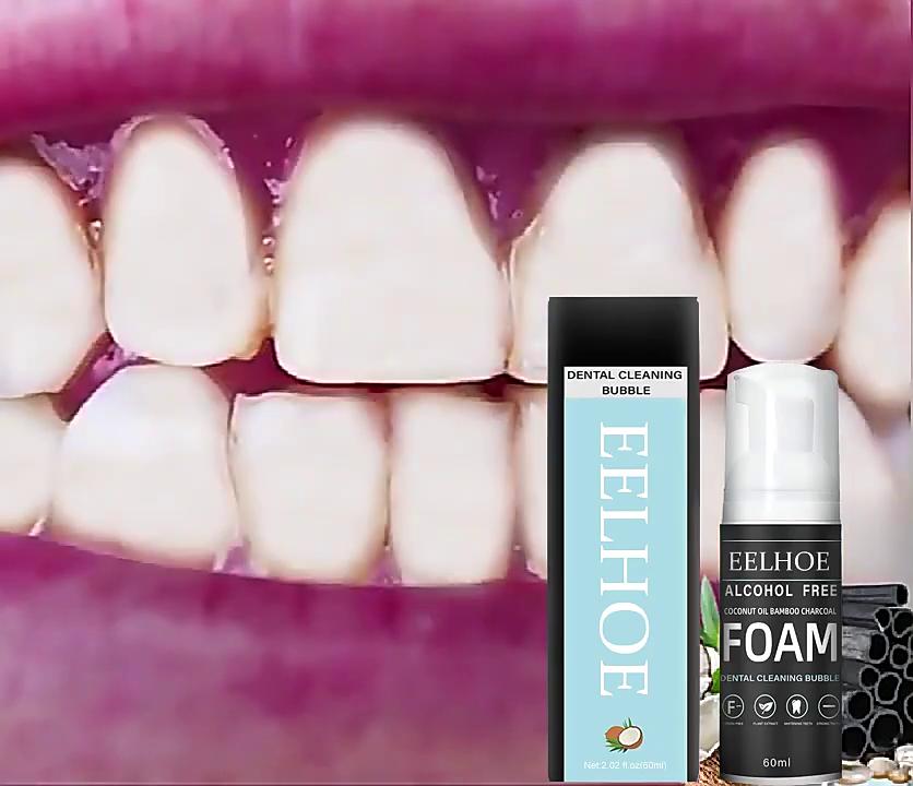 EELHOE Пенная зубная паста для удаления пятен на зубах, чистка рта, зубная паста, отбеливающий мусс, зубная паста, уход за пятнами, зубная паста для десен, 60 мл