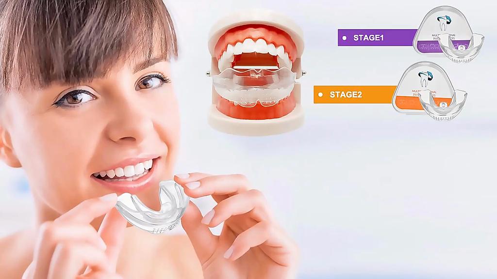 Dental Appliance Tooth Orthodontic Braces Trainer Dental Braces Teeth Trainer Alignment Braces Mouthpiece For Adults Orthodontic