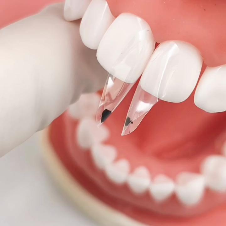 1 пакет (150pcs / уп) Dental Clear Matrix BT Прозрачные матрицы Передние зубы PosteriorFit Bioclear Зубы Молярная дуга Класс Реставрация Черный Треугольник