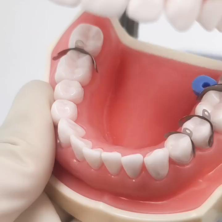 80 шт. Новые стоматологические секционные контурные металлические матрицы набор матриц матричные ленты резиновые клинья с дополнительными клиньями стоматологические материалы