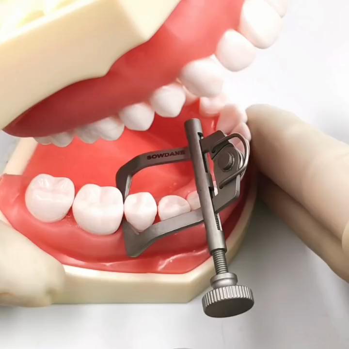 Высококачественный стоматологический разделитель зубов, разделитель зубов, клиновой фиксатор, инструмент для передних зубов, задний инструмент, отбеливание зубов, уход за полостью рта, инструменты для стоматолога