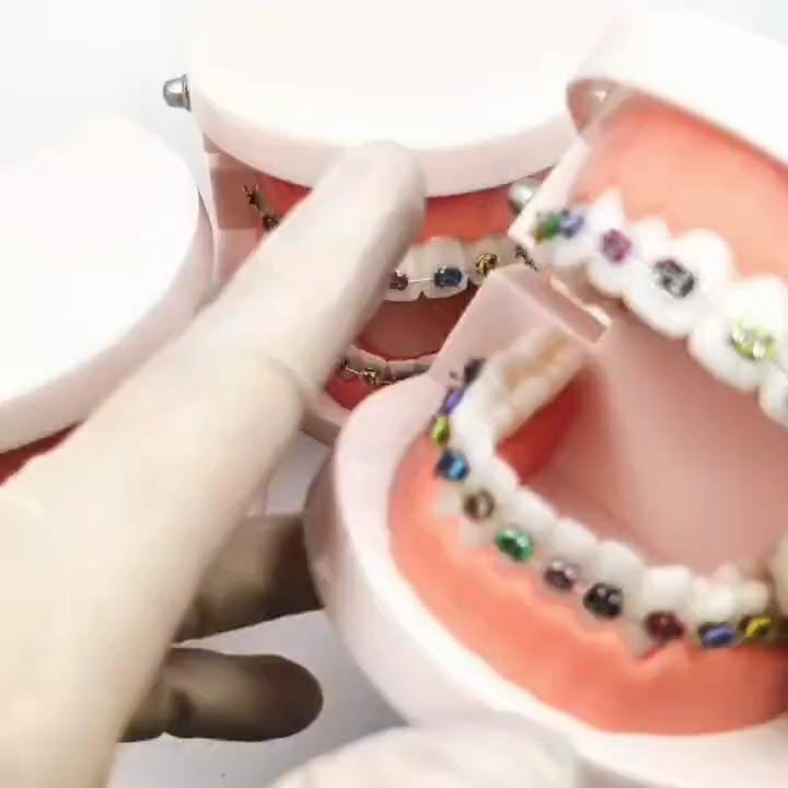 1 шт., стоматологическая модель для ухода за полостью рта, стоматологическая ортодонтическая модель для общения с пациентом, модель для исследования стоматолога