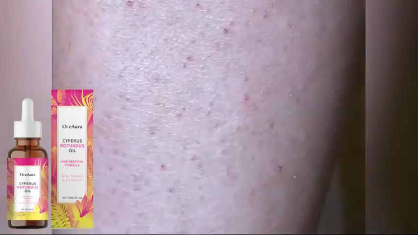 OceAura Hair Removal Care Oil – Lightweight, hydrating, smooth, and silky skin. Gentle and non-irritating hair removal oil